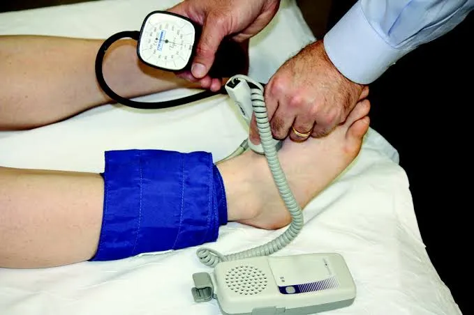 Bagaimana Cara Pemeriksaan Ankle Brakhial Index (ABI), dan Interpretasinya?