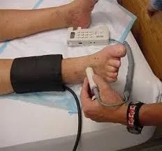 Luka Kaki Diabetes, Apakah Ibu/Bapak Berisiko Tinggi? Kenali Risikonya dengan Pemeriksaan Ankle Brakial Index (ABI) 